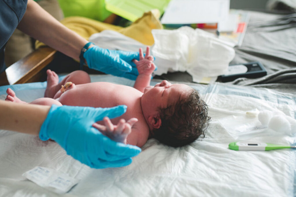 Understanding the APGAR Score: A Key Newborn Assessment
